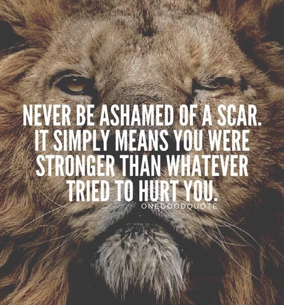 Never be ashamed of a scar. It simply means you were stronger than whatever tried to hurt you.